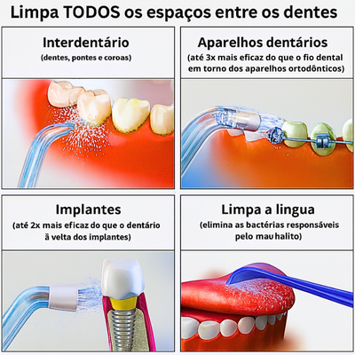 Hidropulsor dentário