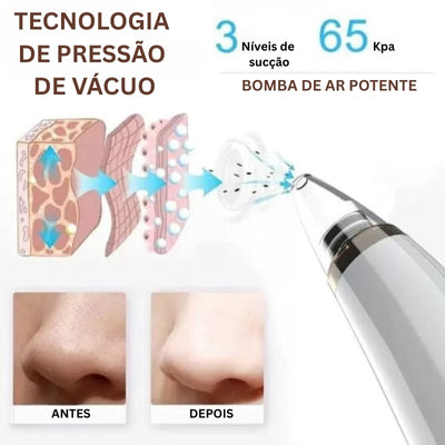 Limpador de Poros 5 em 1