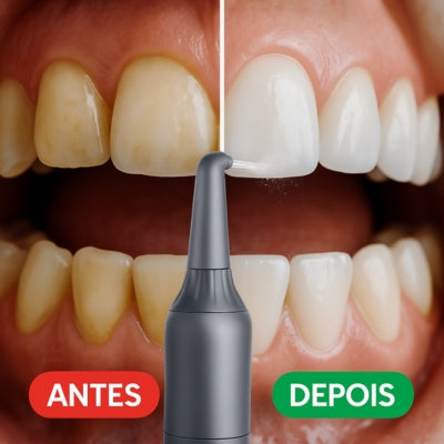Hidropulsor dentário