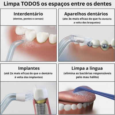 Hidropulsor dentário