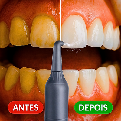 Hidropulsor dentário